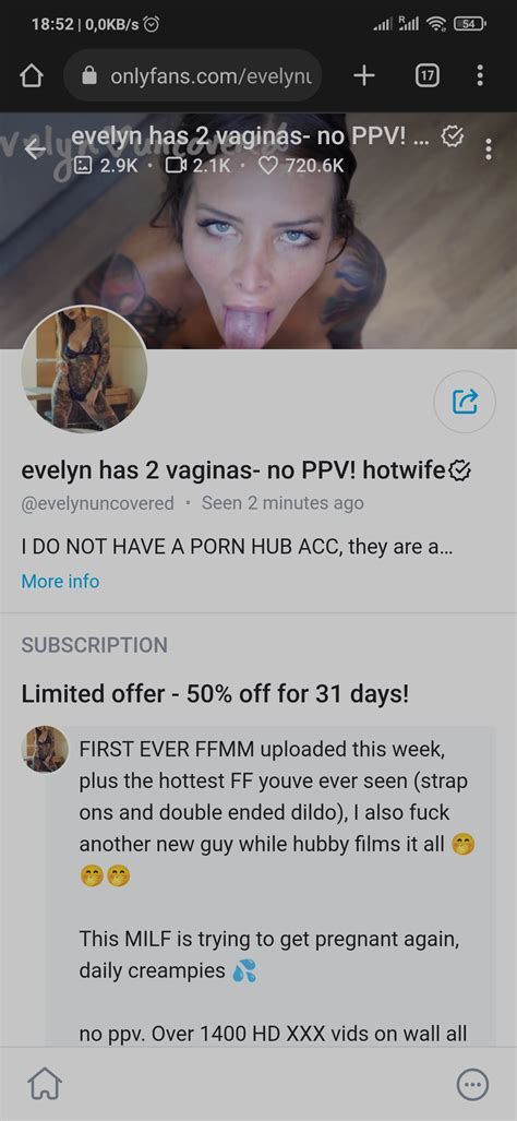 evelyn miller 2 vaginas|I have two uteruses